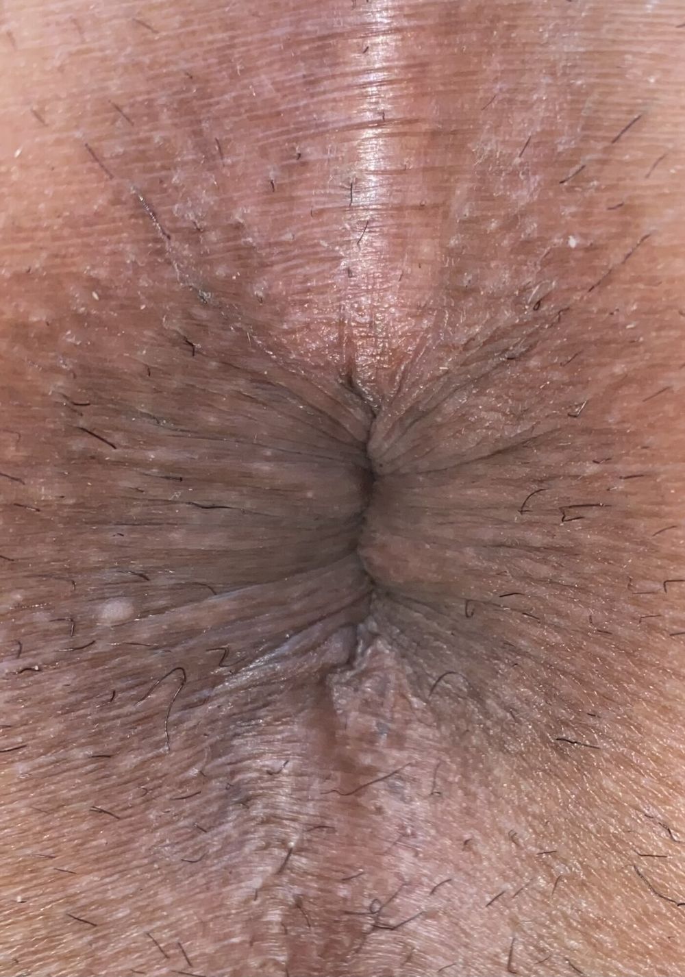 Close-up of a man&#039;s anus #13