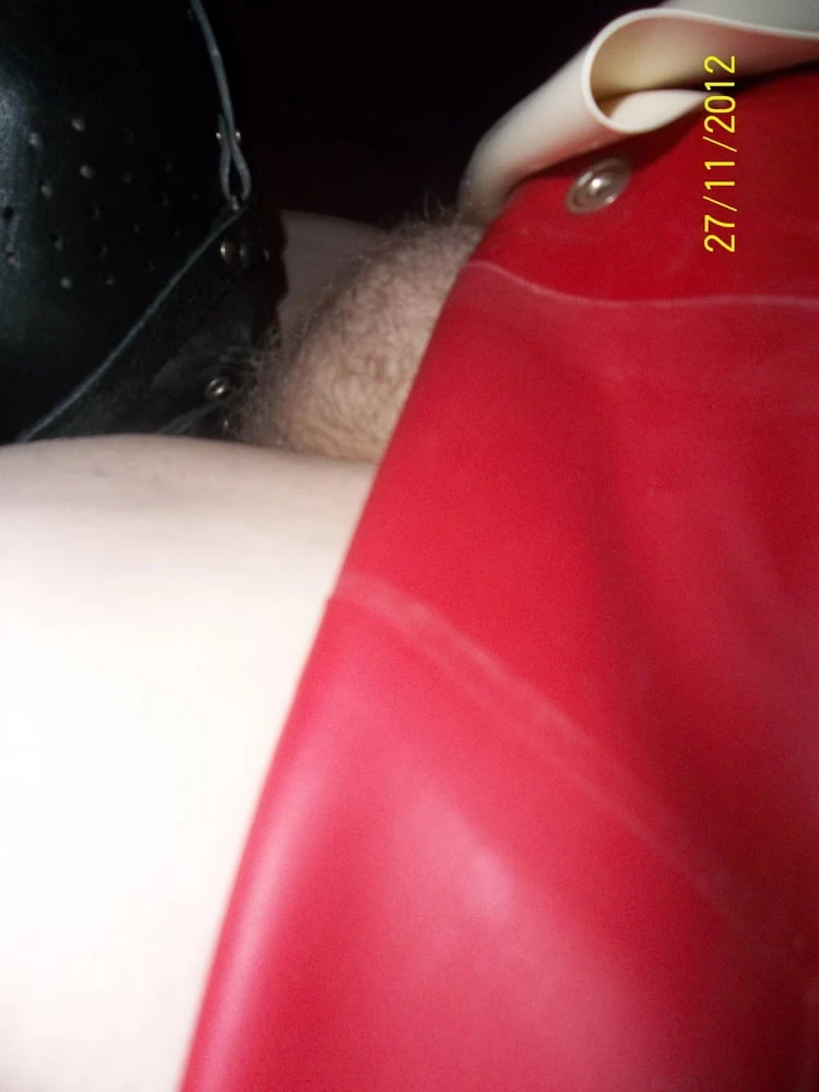 TREATMENT PT 2 #14