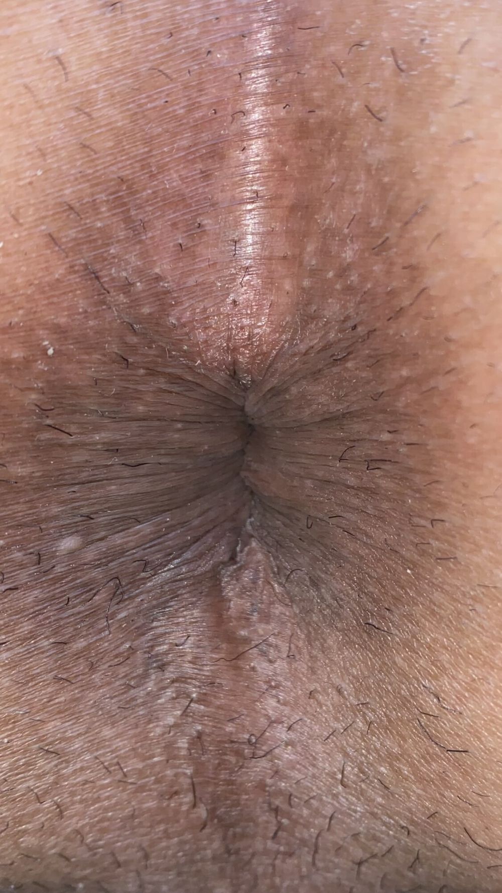 Close-up of a man&#039;s anus #9