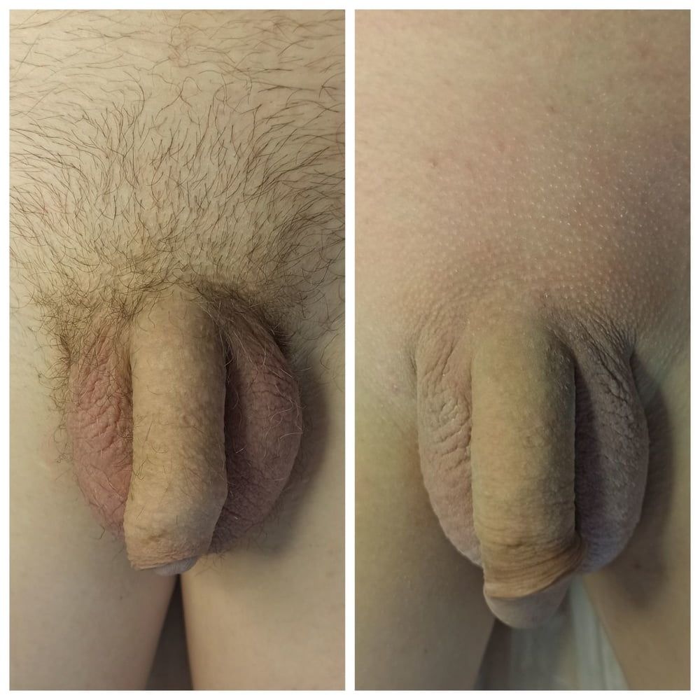 Look! After my procedure, all the dicks really got bigger!  #25
