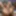 Elen Million&#039;s double prolapse