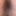 An image of my anus that is clear to every single wrinkle