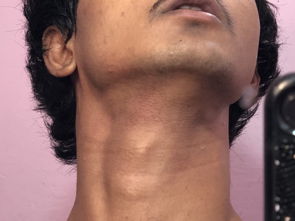 Pics of my slim  body 