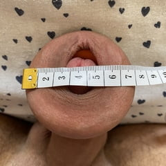 Extreme foreskin stretching