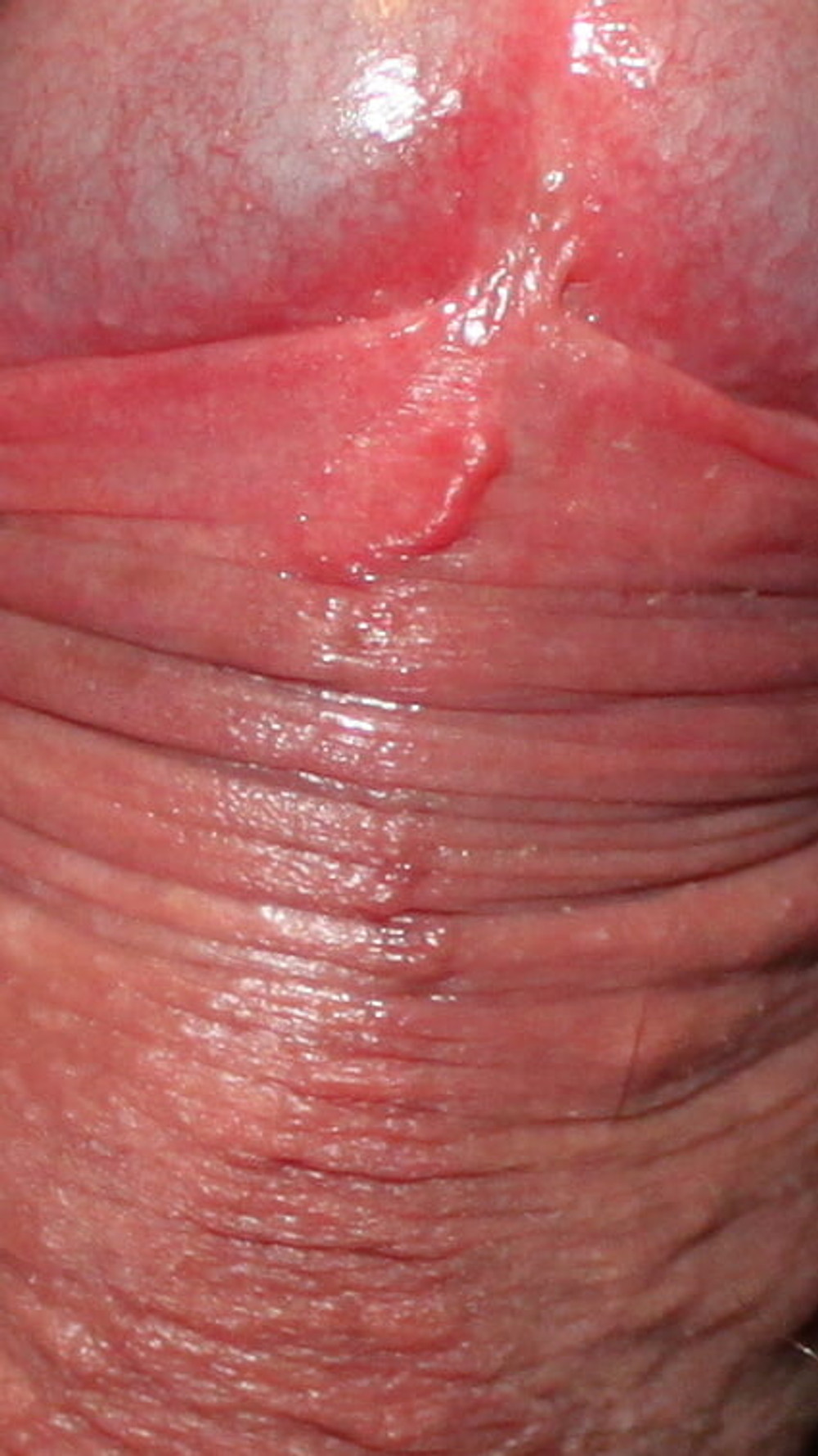 Close up dick #19