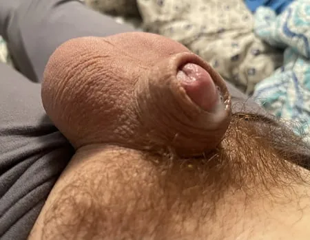 my tiny inverted cock         