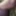 Tugging my foreskin - Foreskin restoration - Aug 2025 #6