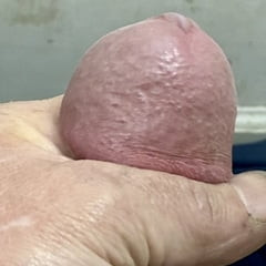 Dick Pics