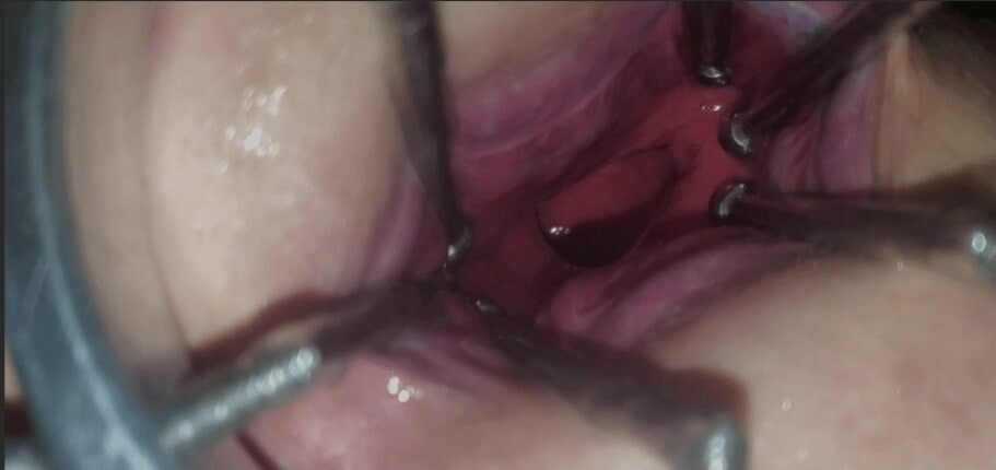 Feeding my asshole with a huge  cucumber  #18