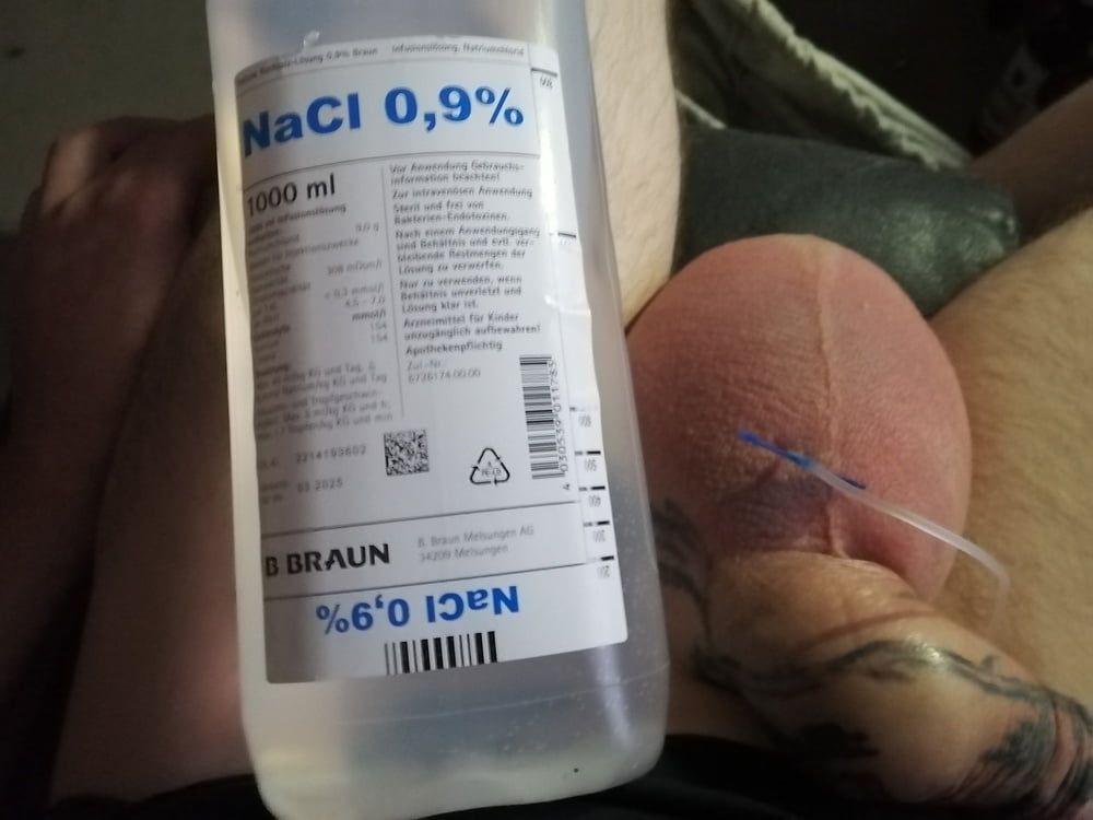 saline-infusion in scrotum - second 2 liter #2