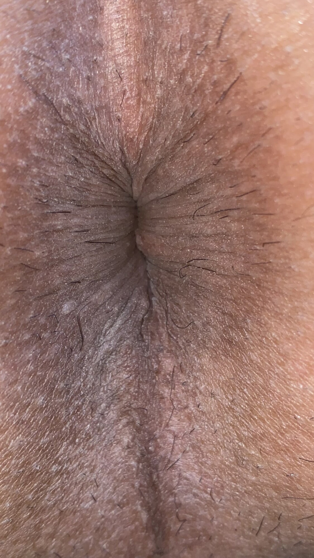 Close-up of a man&#039;s anus