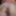 THIS IS WHAT MY ASS LOOKS LIKE AFTER AN ANAL WITH A HUGE DIL #2