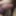 Tugging my foreskin - Foreskin restoration - Aug 2025