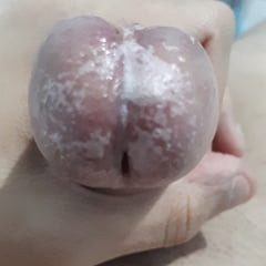 Wet Glans Penis