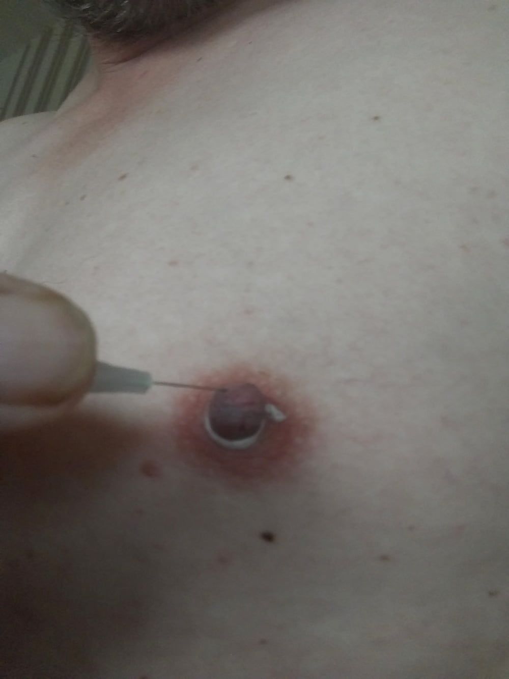 some more needles in my nipples #7
