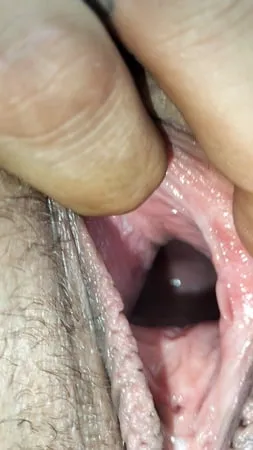 cum covered cervix         