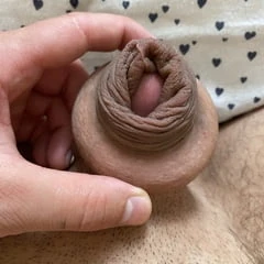 Foreskin extending with donut ring
