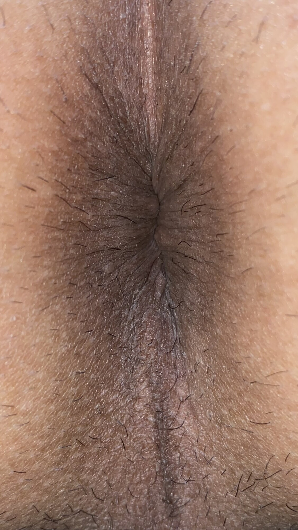 Close-up of a man&#039;s anus #22