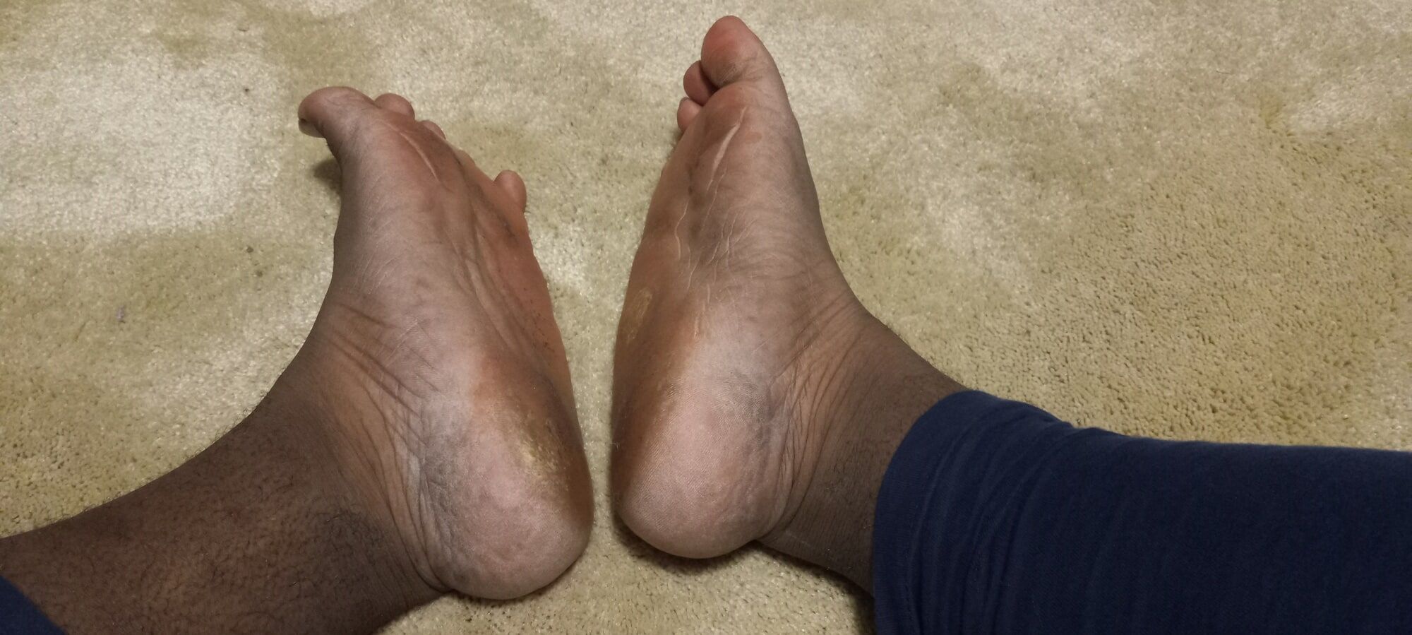 Pics of my Feet #17