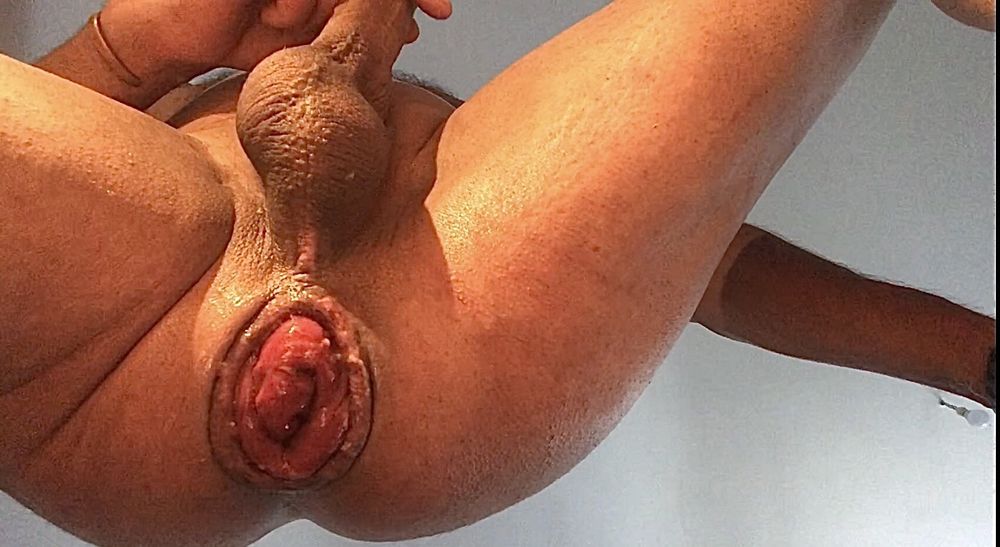 wow nice progress anal prolapse #23