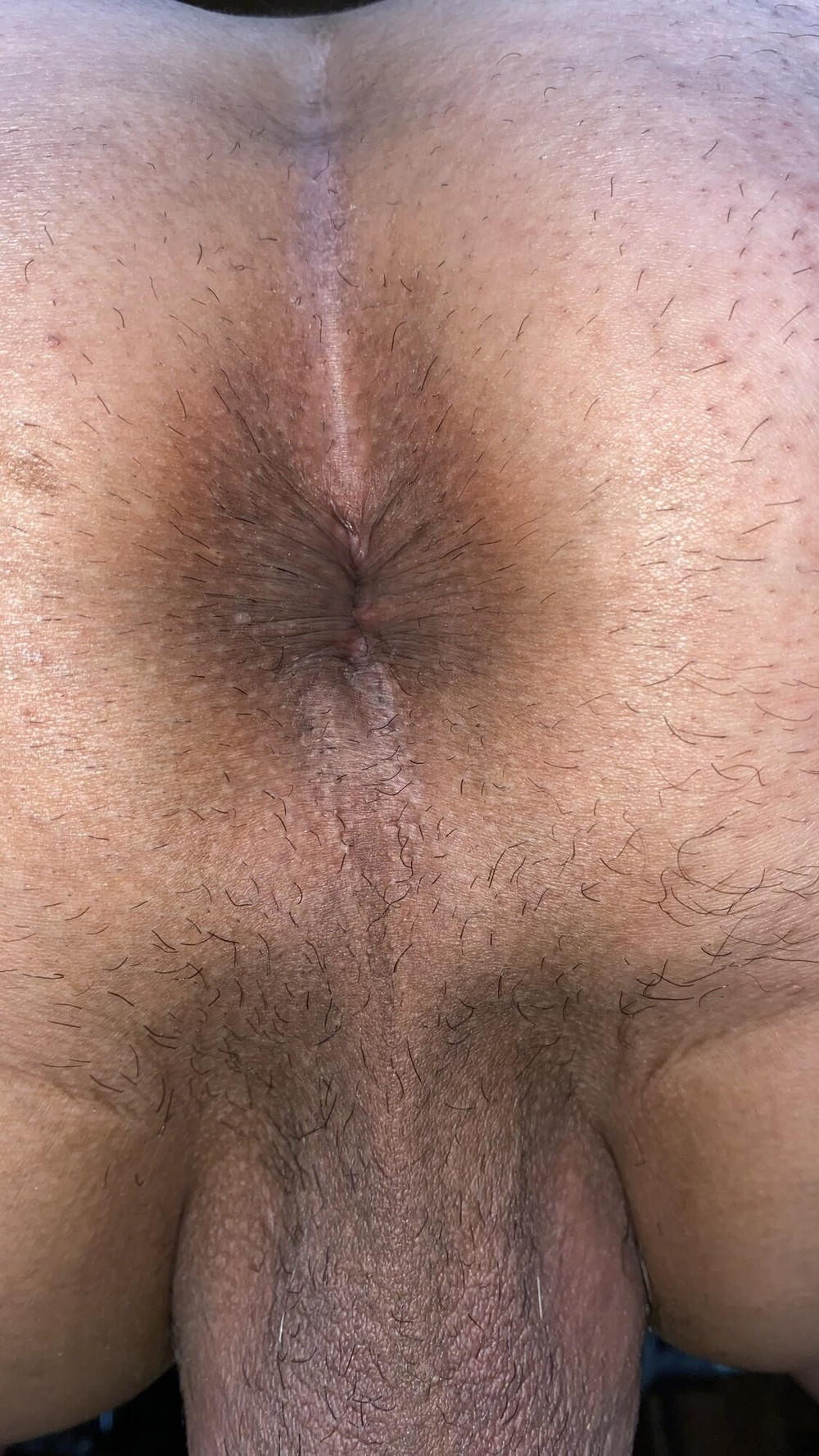 Close-up of a man&#039;s anus #13