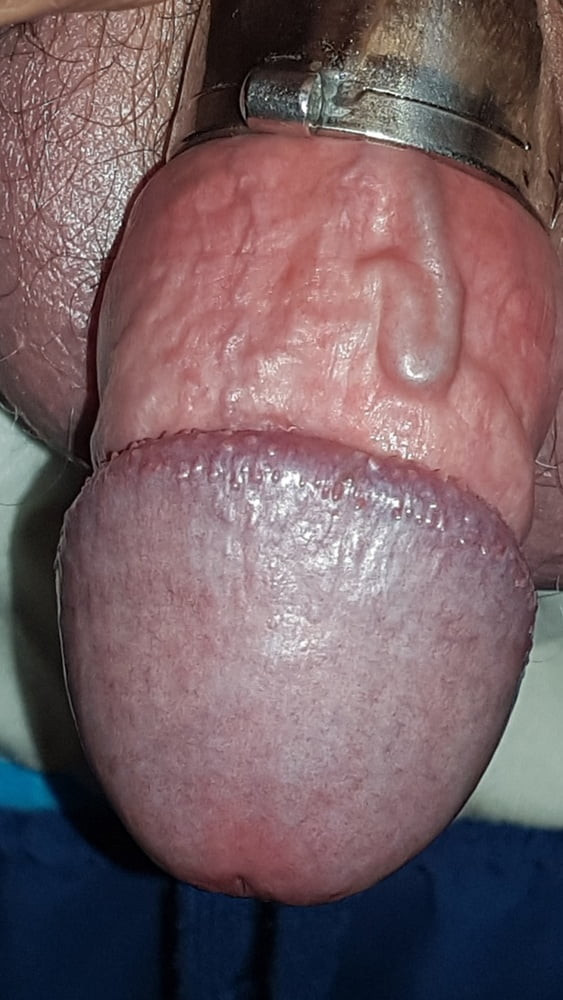 Chastity cage