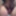 Labia reveal
