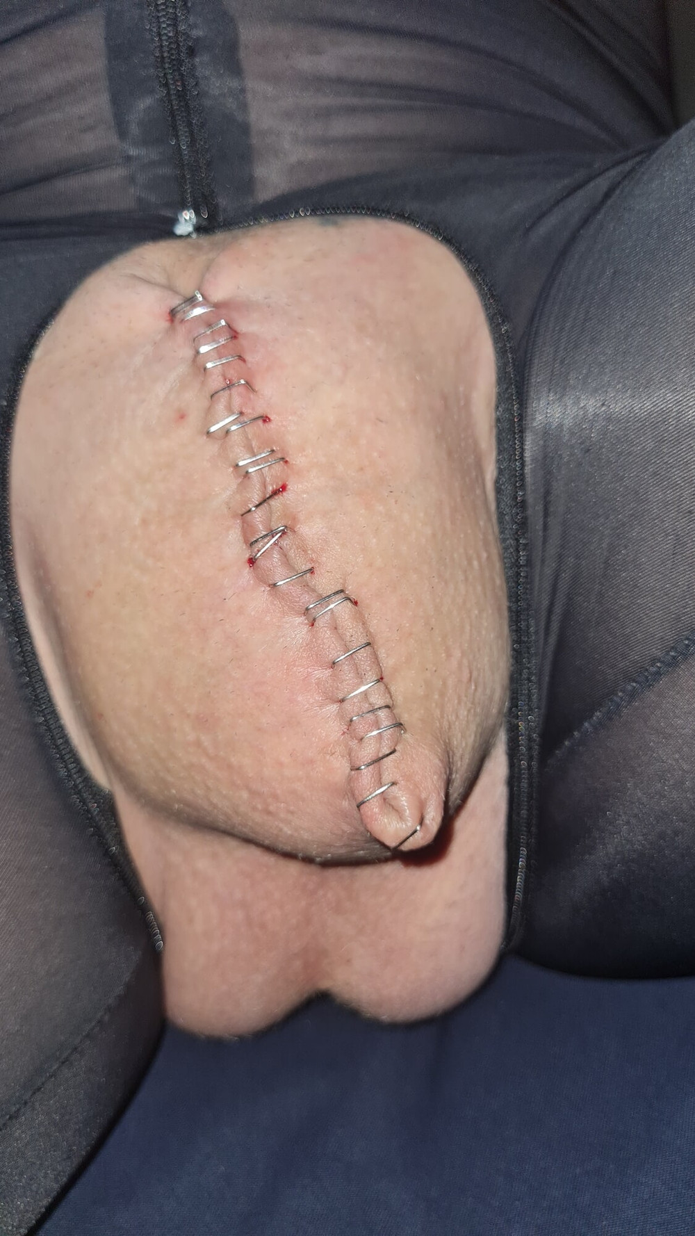 Stapled cock and balls #5