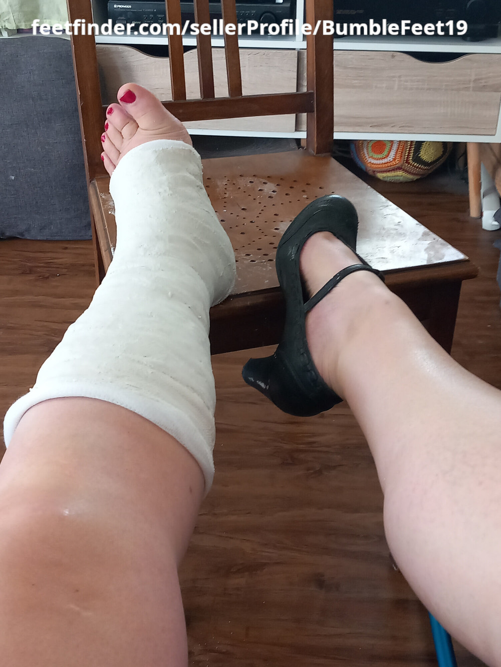 Session: Applying a short leg cast (SLC) on my left leg #8