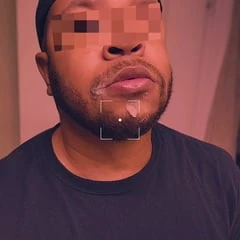 Facial