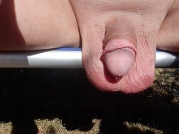 Scrotum becomes long #16