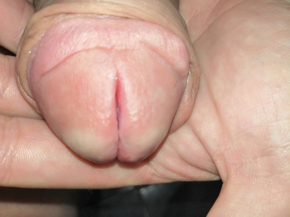 Split penis #4