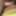 Dick