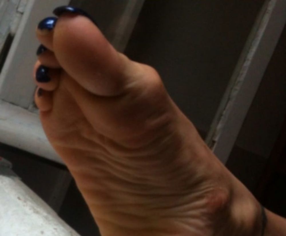 blue toenails and soles feet after day at beach  #4