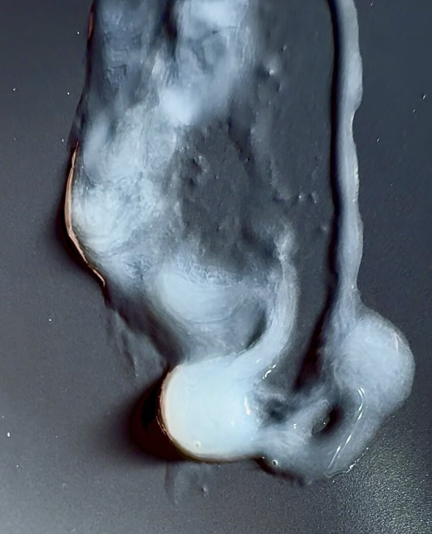 Παχύ και κολλώδες φορτίο