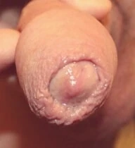Dick