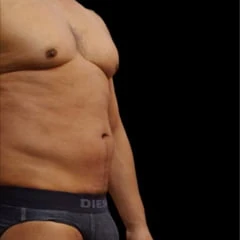Package