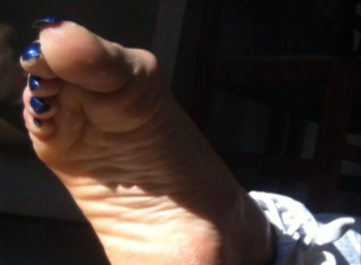 Blue toenails under sun ray #6