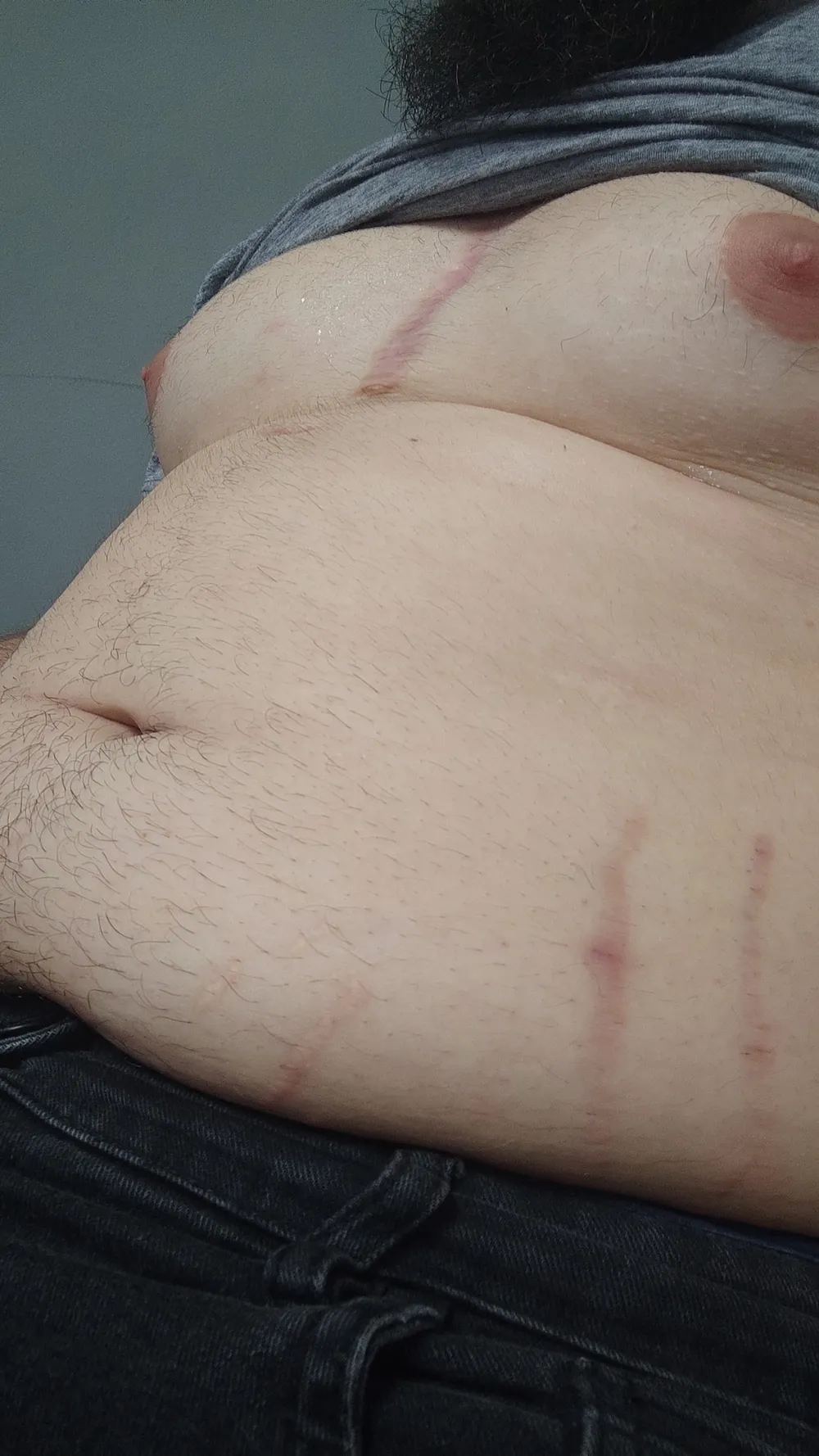 My belly and my chest