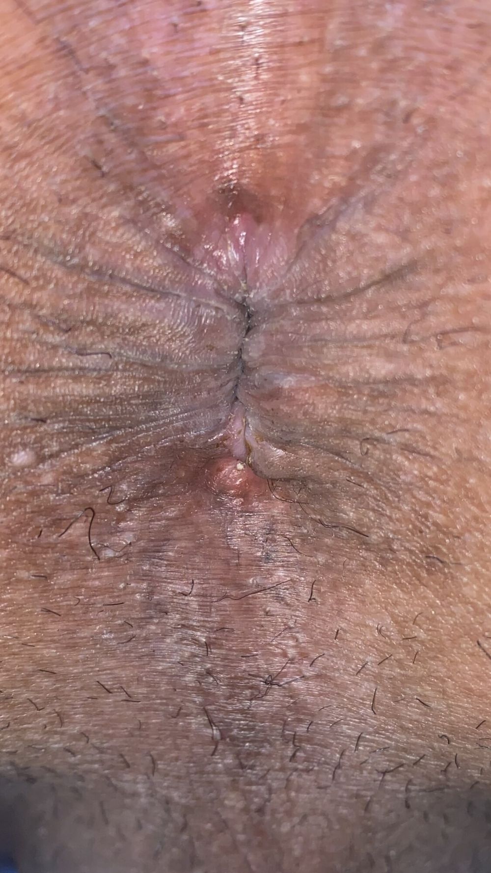 Close-up of a man&#039;s anus #17