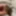 extended foreskin #6