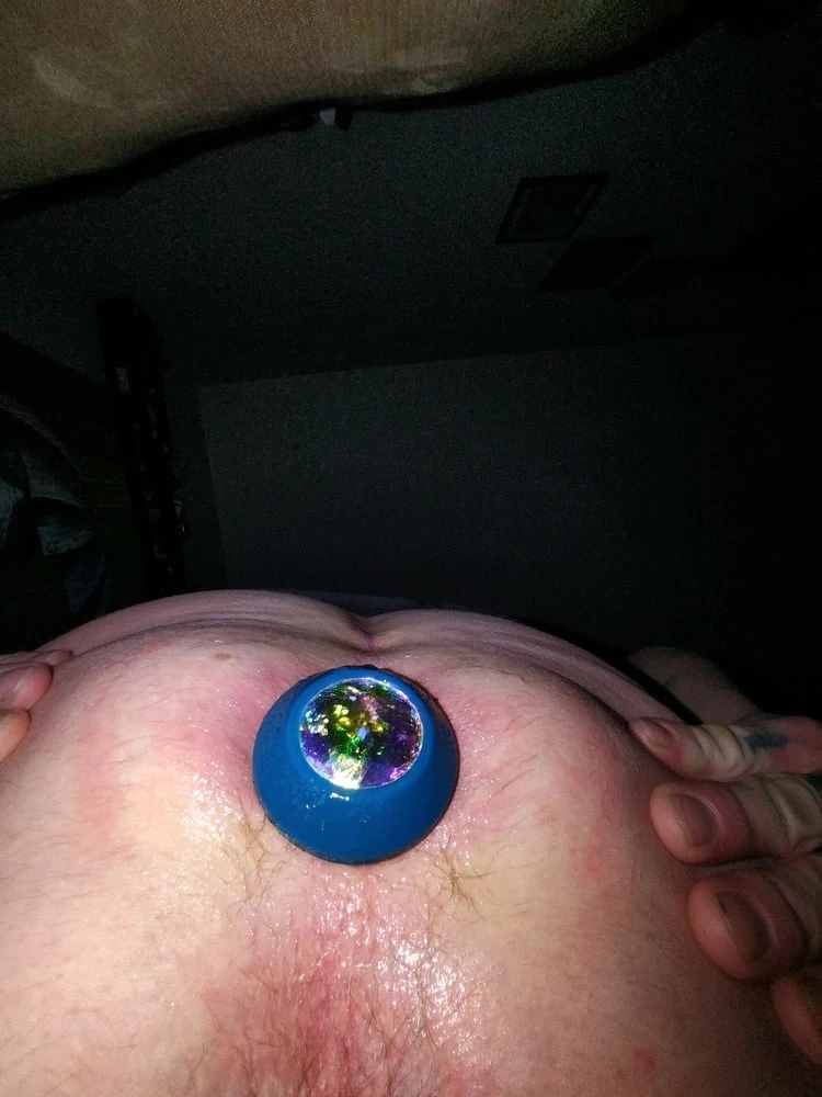Anal 
