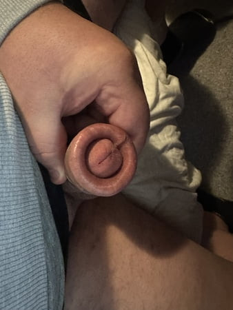 Foreskin