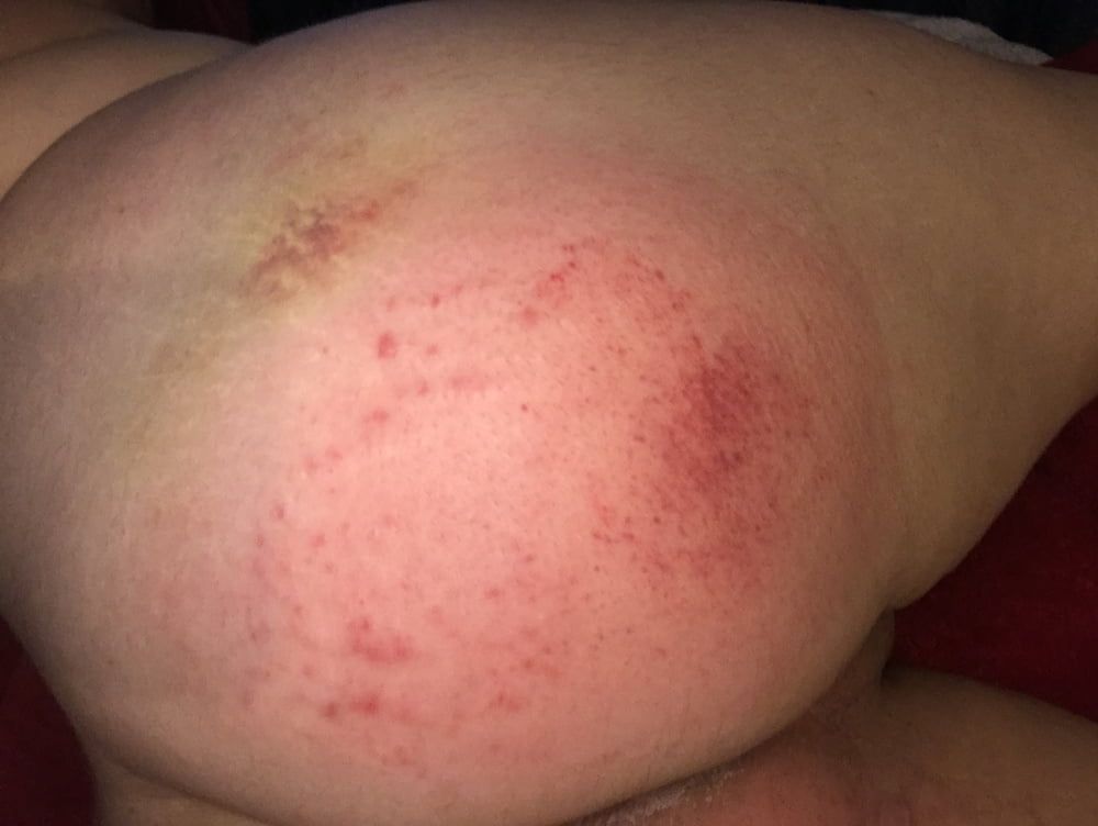 Posting my bottom after I&#039;m punished  #8