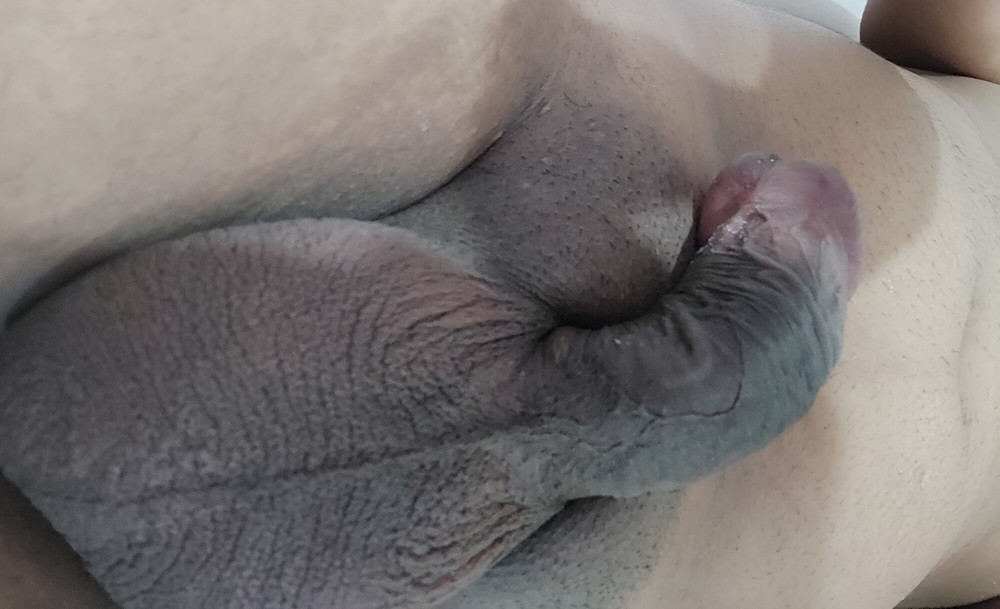 My penis I pulled my foreskin back #11