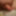 My Small Penis