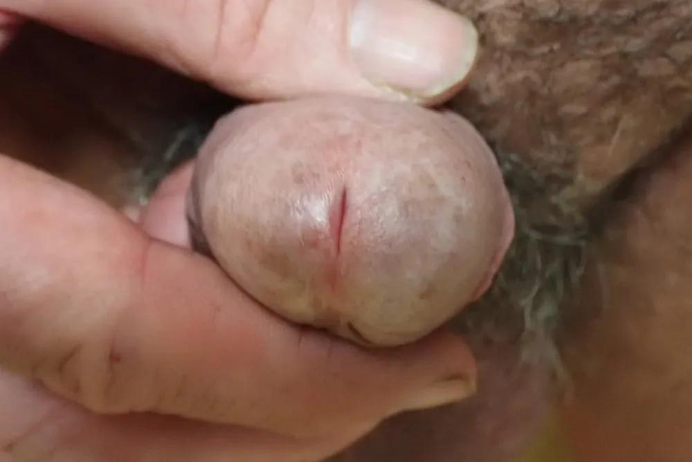 my penis up close #10