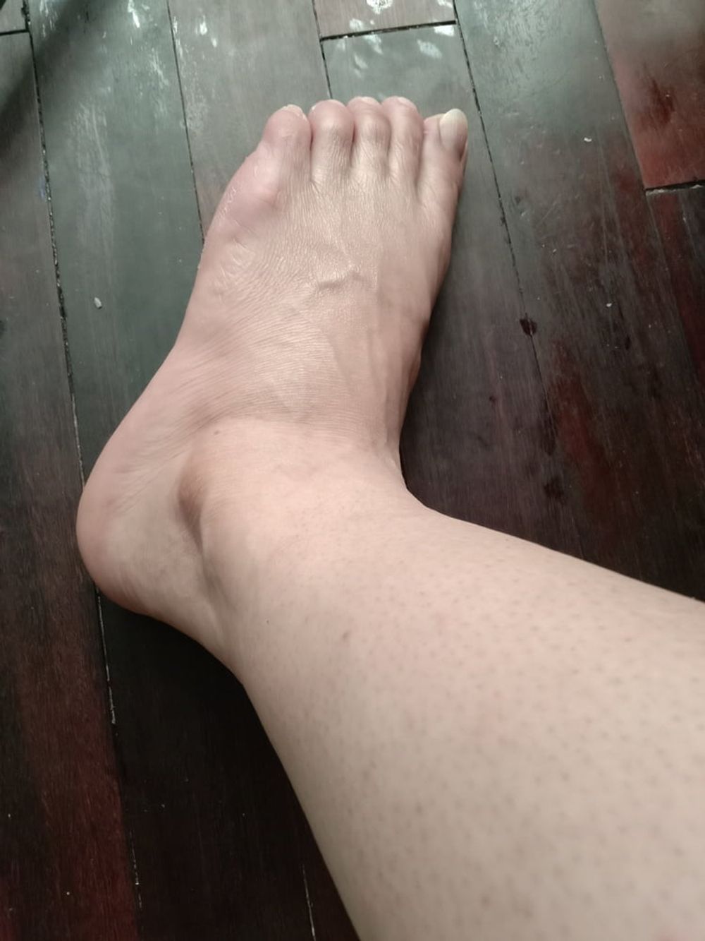 foot #3