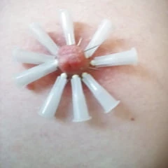 Nadeln 3