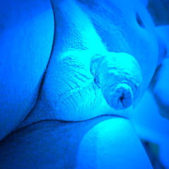  P01